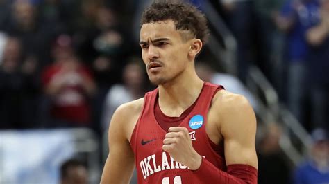 trae young hairline